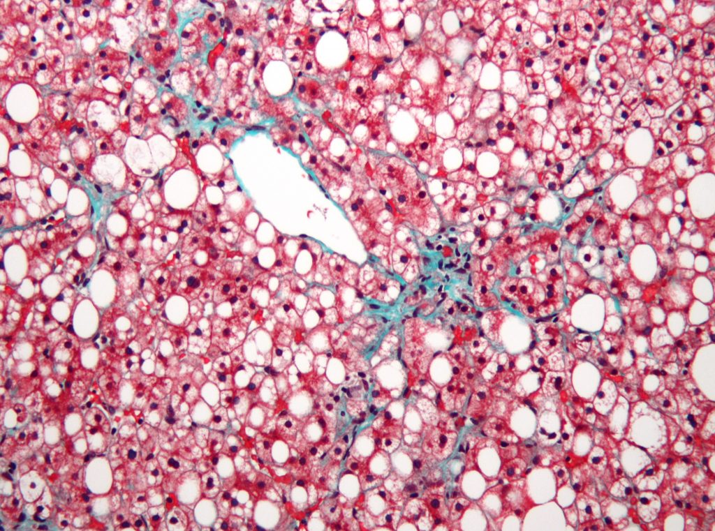 Image of liver cells