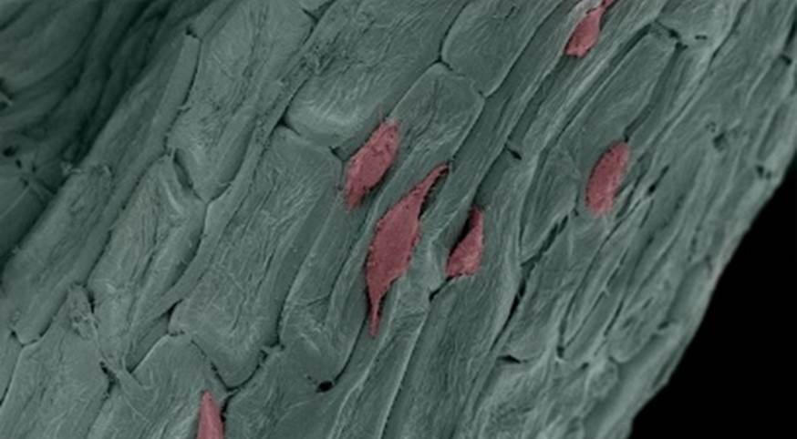 Human skin cells (pink) migrating upon a medical device (green) that was manufactured from a parsley leaf.