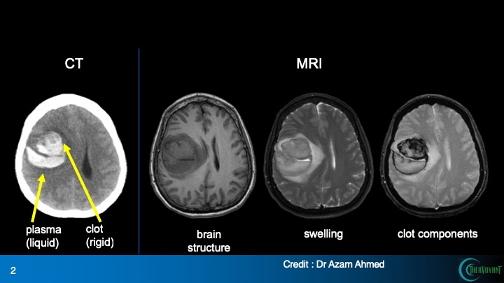 Images of brain CT and MRI scans