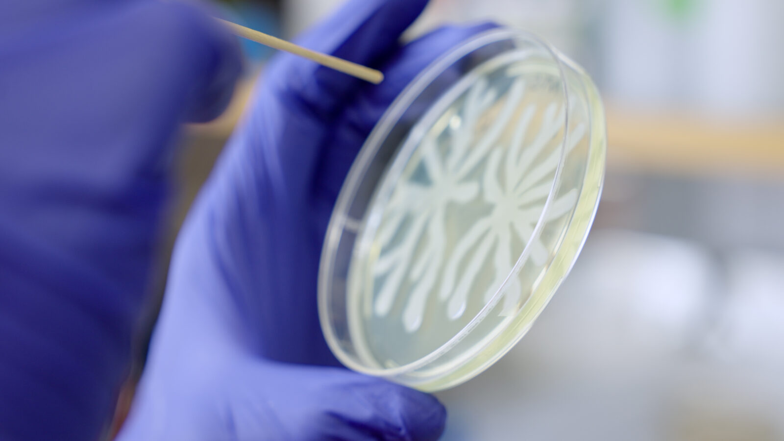 Close up of Petri dish with bacteria